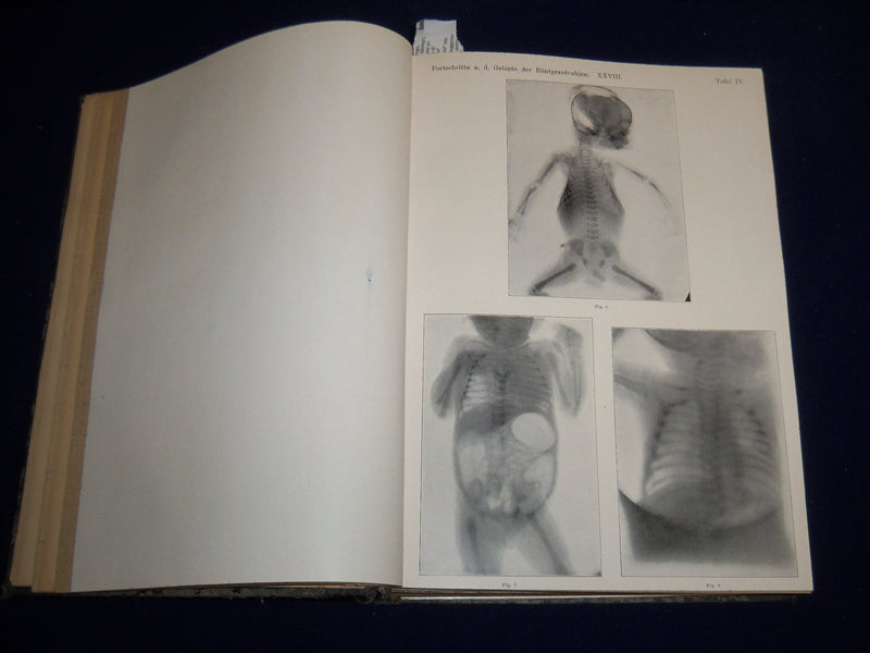 1921-1922 FORTSCHRITLE AUF DEMGEBIETE DER RONTGENSTRAHLEN VOLUME - KD 2951P