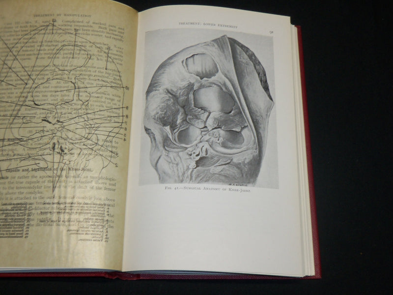 1948 TREATMENT BY MANIPULATION BOOK BY A. G. TIMBRELL FISHER - 5TH EDN- KD 2765Y