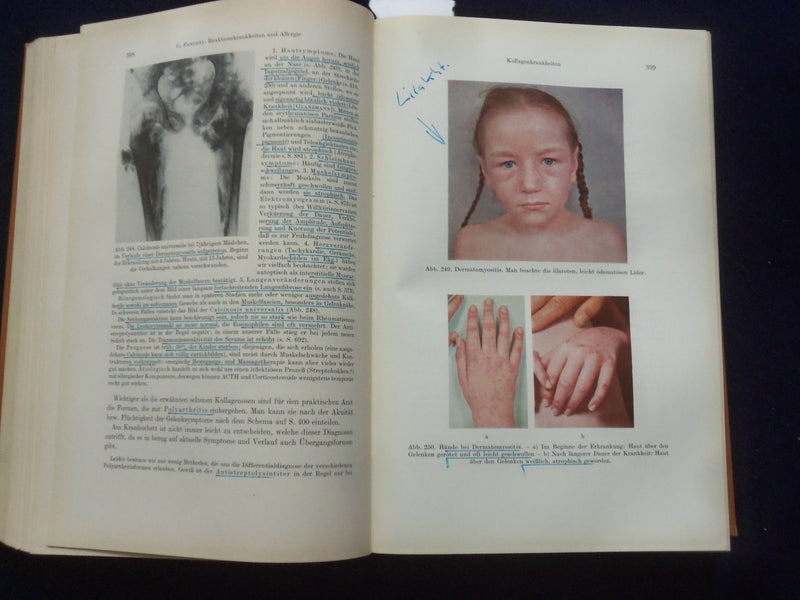 1961 LEHRBUCH DER PADIATRIE HARDCOVER BOOK - GERMAN TEXT - KD 8990