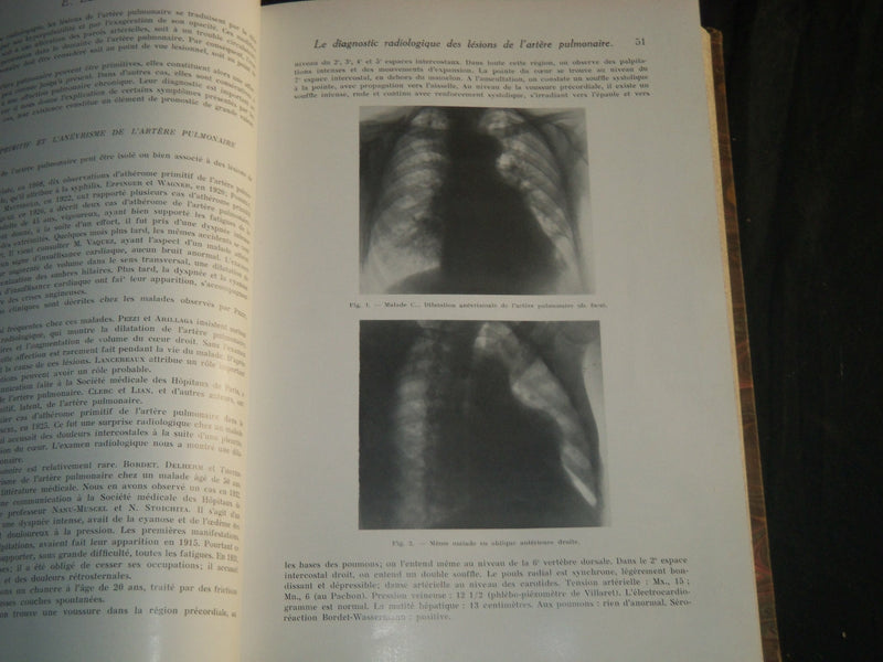 1932-1938 JOURNAL DE RADIOLOGIE ET D'ELECTROLOGIE BOUND VOLUMES LOT OF 6 - KD 6