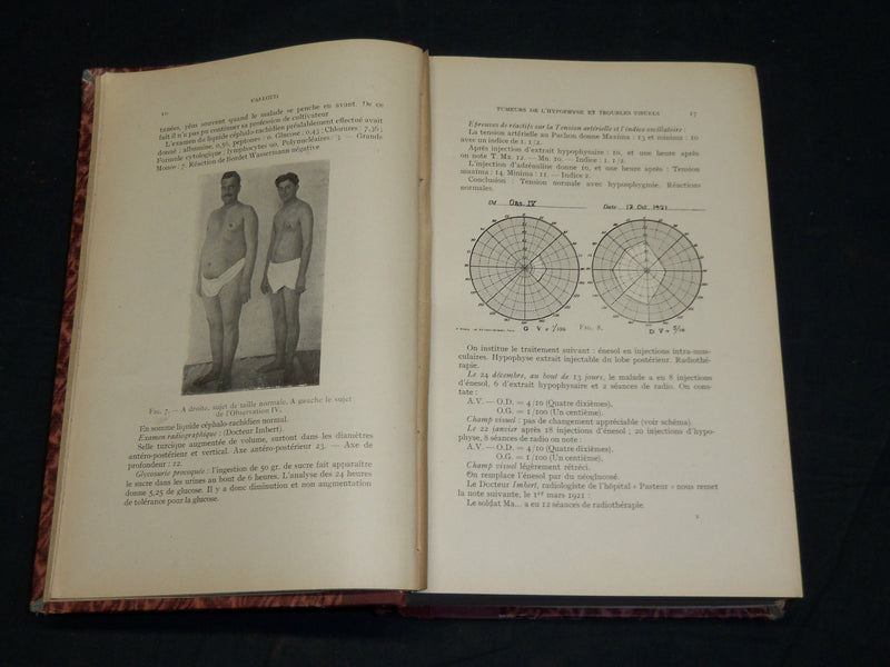1906-1922 ANNALES D'OCULISTIQUE FRENCH VOLUMES LOT OF 8 - NICE PLATES - KD 21E
