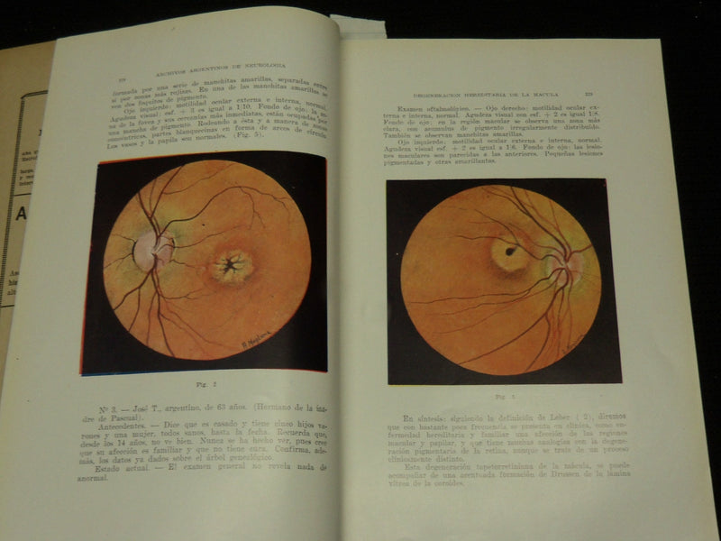 1927-1935 ARCHIVES ARGENTINOS DE NEUROLOGIA SPANISH MAGAZINES LOT OF 5 - WR 505E