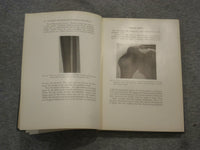 1921 INJURIES & DISEASES OF THE BONES AND JOINTS BY BAETJER & WATERS - KD 2759C