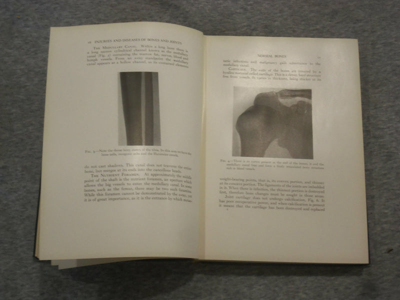 1921 INJURIES & DISEASES OF THE BONES AND JOINTS BY BAETJER & WATERS - KD 2759C