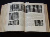 1935 JUL-DEC SURGERY, GYNECOLOGY AND OBSTETRICS MAGAZINE BOUND VOLUME -KD 4784B