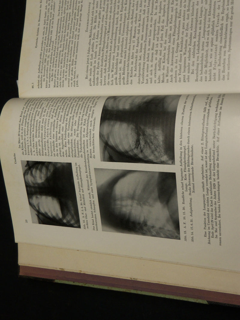 1932 FORTSCHRITTE AUF DEM GEBIETE DER RONTGENSTRAHLEN GERMAN VOLUME - KD 1945E