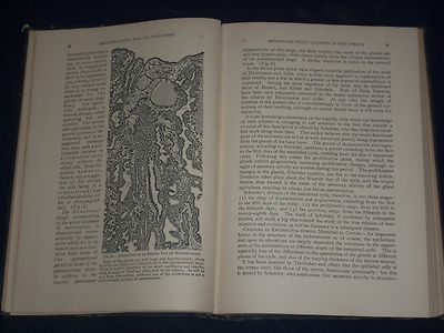 1921 GYNECOLOGICAL & OBSTETRICAL MONOGRAPHS APPLETON VOLUME LOT OF 14 - KD 2998