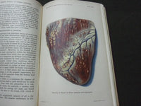 1913 28TH ANNUAL REPORT OF THE BUREAU OF ANIMAL INDUSTRY BOOK - KD 1775B