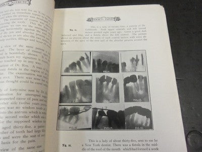 1905 NOVEMBER ITEMS OF INTEREST MAGAZINE - DENTAL ADVERTISEMENTS - II 7101