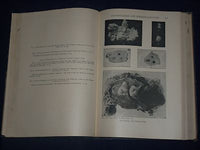 1921 GYNECOLOGICAL & OBSTETRICAL MONOGRAPHS APPLETON VOLUME LOT OF 14 - KD 2998