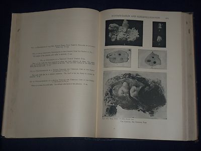 1921 GYNECOLOGICAL & OBSTETRICAL MONOGRAPHS APPLETON VOLUME LOT OF 14 - KD 2998