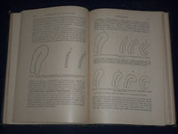 1921 GYNECOLOGICAL & OBSTETRICAL MONOGRAPHS APPLETON VOLUME LOT OF 14 - KD 2998
