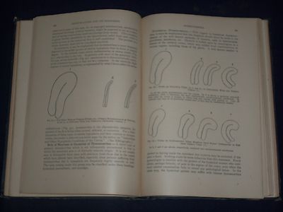 1921 GYNECOLOGICAL & OBSTETRICAL MONOGRAPHS APPLETON VOLUME LOT OF 14 - KD 2998